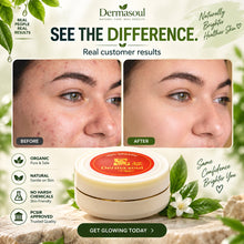 Dermasoul